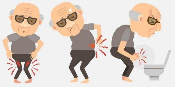 Symptome einer Prostatitis