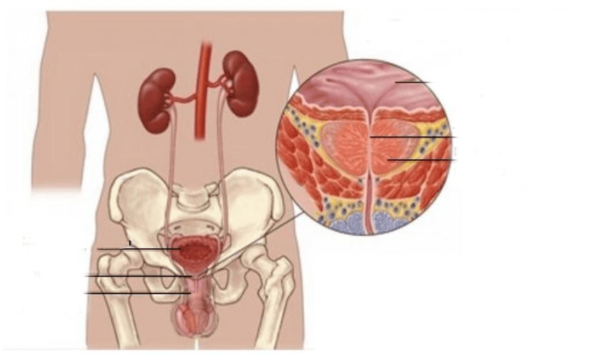 Prostatitis bei Männern