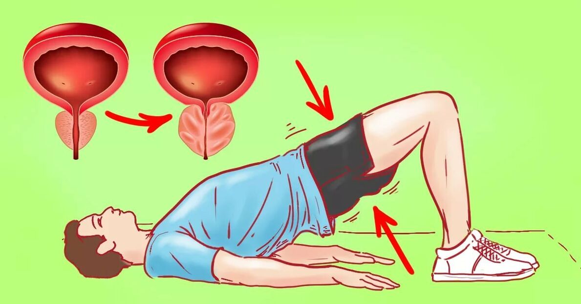 Übungen gegen Prostatitis
